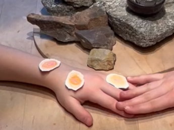 Eine Hand mit gelblichen Flecken, eine andere Hand kommt langsam darüber, im Hintergrund große Steine